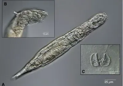 Magnified image featuring a full view of a bdelloid rotifer recovered from permafrost (labeled A) along with two insets: one side view of the organism’s head (labeled B) and a view of its mouthparts (labeled C)